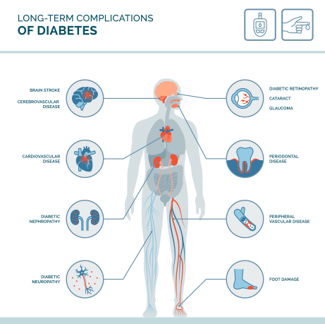 Treatment of Diabetic Complications: How Can We Learn by Seeking