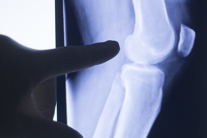 orthopedic-pain-2.png