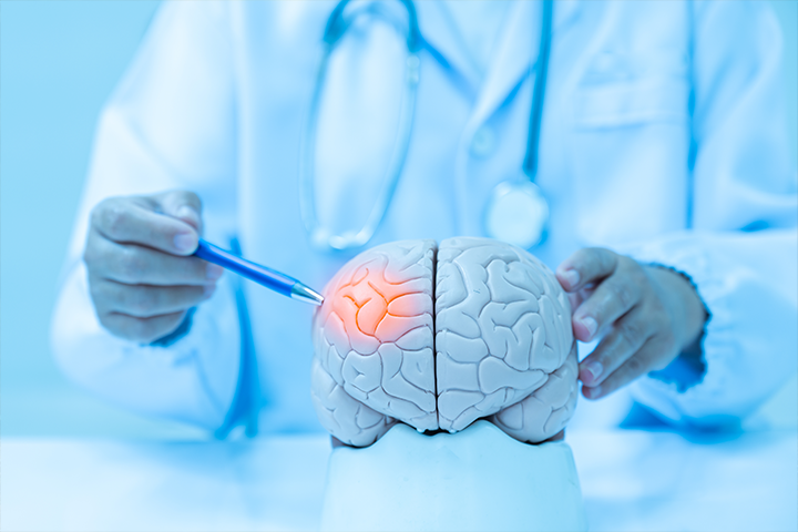 doctor pointing at brain model