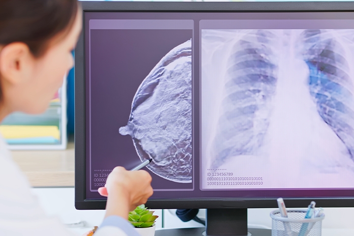 doctor pointing at imaging results
